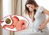 Mắc bệnh đau dạ dày khi mang thai cần lưu ý những gì?